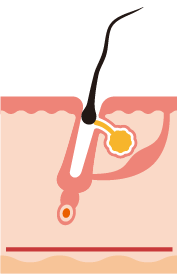 Telogen phase (or fall)
